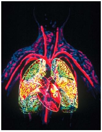 An image of the main components of the human circulatory system. The heart (placed between the lungs) delivers blood to the lungs, where it picks up oxygen and circulates it throughout the body by means of a system of blood vessels. (Reproduced by permission of The Stock Market.)