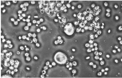 BAKER'S YEAST, SINGLE-CELL FUNGI THAT PRODUCE CARBON DIOXIDE IN THE OXIDATION OF SUGAR. CARBON DIOXIDE CAUSES BREAD TO RISE WHEN YEAST IS MIXED INTO DOUGH, A RESULT OF THE FERMENTATION OF THE SUGAR BY ENZYMES IN THE YEAST. (© Lester V. Bergman/Corbis. Reproduced by permission.)