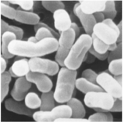 ESCHERICHIA COLI is a type of bacteria that lives in the intestinal tract, aiding the digestive process by suppressing the growth of harmful bacteria and synthesizing vitamins. (&#xA9; 1997 Custom Medical Stock Photo. Reproduced by permission.)