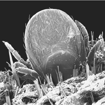 SCANNING ELECTRON MICROGRAPH OF A TICK FEEDING IN HUMAN SKIN. ATICK IS A PARASITIC ARTHROPOD THAT CAN SERVE AS A VECTOR FOR BACTERIAL INFECTIONS, SUCH AS ROCKY MOUNTAIN SPOTTED FEVER. (Photo Researchers. Reproduced by permission.)