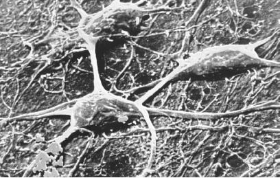 CHEMORECEPTION IS THE MEANS BY WHICH AN ORGANISM RECEIVES SIGNALS REGARDING CHEMICAL CHANGES IN ITS ENVIRONMENT, TRANSLATING THEM INTO PROCESSES WITHIN THE BODY AND BRAIN. NERVE CELLS, SUCH AS THE ONES SHOWN HERE, MAKE UP A NETWORK OF PRIMARY RECEPTORS THAT RECEIVE AND INTERPRET STIMULI AND TRANSMIT MESSAGES BASED ON THESE SENSORY DATA TO THE BRAIN. (Photograph by Secchi-Lecague/Roussel-UCLAF/CNRI/Science Photo Library. National Audubon Society Collection/Photo Researchers, Inc. Reproduced by permission.)