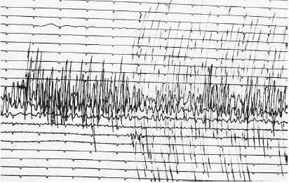 A SEISMOGRAPH READING FROM THE 1989 LOMA PRIETA, CALIFORNIA, EARTHQUAKE. (© Russell D. Curtis/Photo Researchers. Reproduced by permission.)
