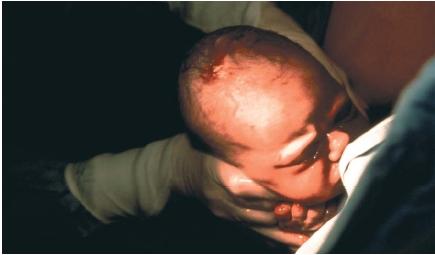 A human baby being born. (Reproduced by permission of Photo Researchers, Inc.)