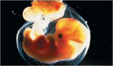 A human embryo at five to six weeks of development. (Reproduced by permission of Photo Researchers, Inc.)