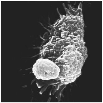 A macrophage (background) and a lymphocyte (fore-ground). (Reproduced by permission of Phototake.)