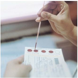 A technician performing a test for phenylketonuria (PKU). (Reproduced by permission of Custom Medical Stock Photo, Inc.)