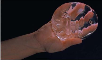 A silicone breast implant. (Reproduced by permission of The Stock Market.)