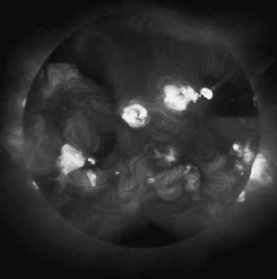 The bright patches in this X-ray image of the Suns outer atmosphere, or corona, are X-rays emitted from extremely hot gases.