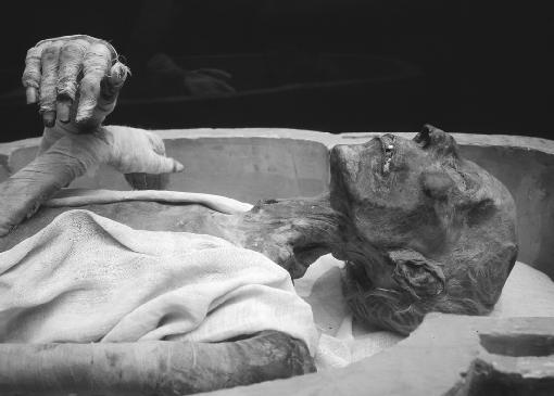 Bacteria and viruses have infected humans for thousands of years. Some Egyptian mummies bear scars or other evidence of viral disease.
