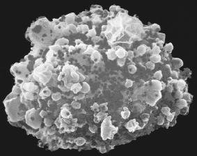 An electron micrograph shows a T cell infected with the HIV virus. The virus can lie dormant in the human body for years before it develops into AIDS.