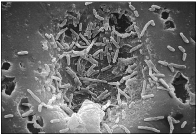 Single-celled bacteria infect a host. These organisms are far simpler creatures than their multicelled counterparts.