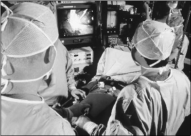 Surgeons use a tiny laser to cut away tissue in a gallbladder operation. The laser and a tiny camera are inserted into the navel, so no abdominal incision is necessary.